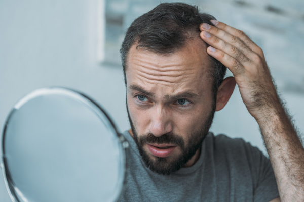 Noticing Hair Loss? These 5 Reasons Might Be Why